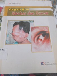 Image of Cegah dini kanker dan tumor